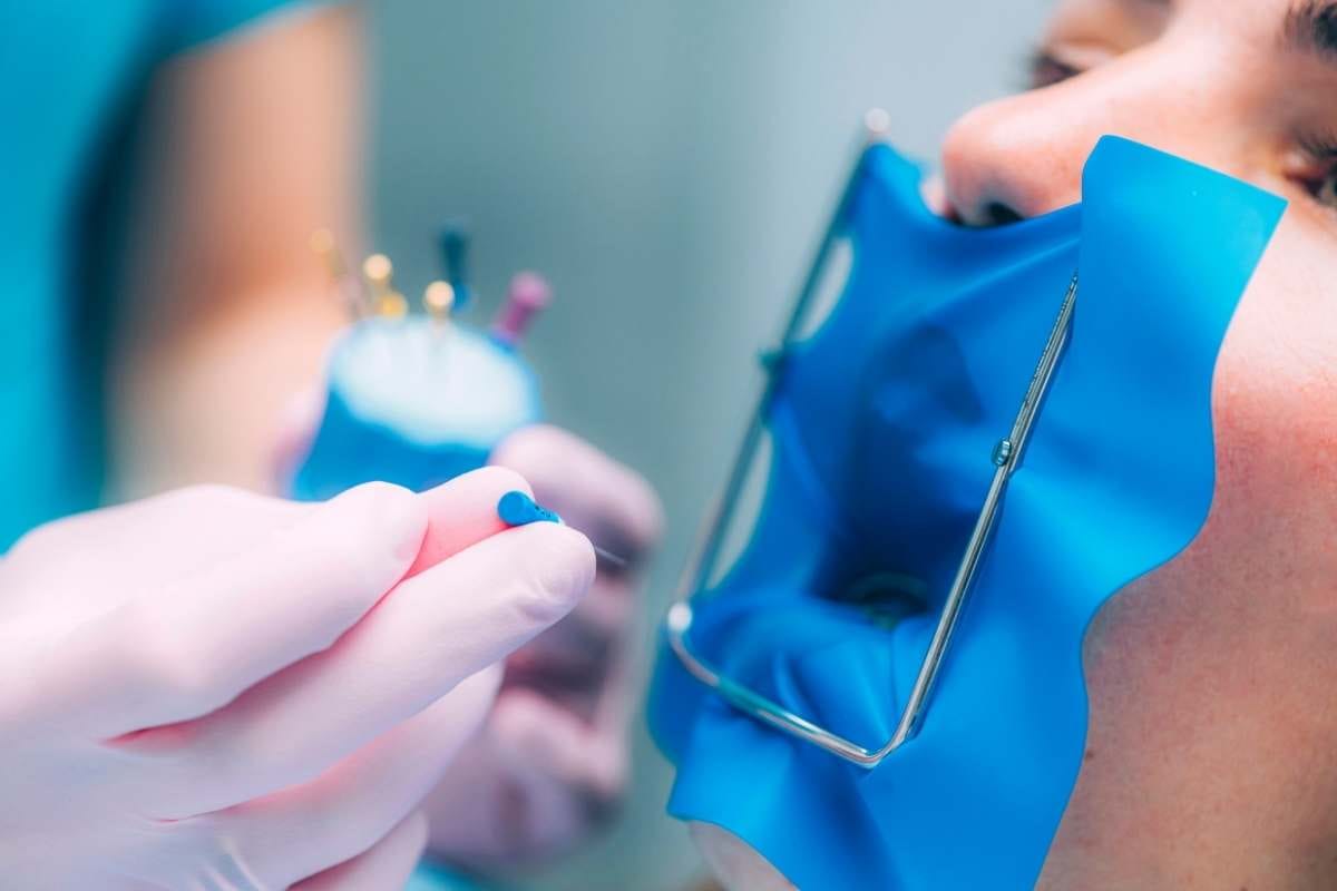 Endodonti (Kanal Tedavisi) Endodonti (Kanal Tedavisi)