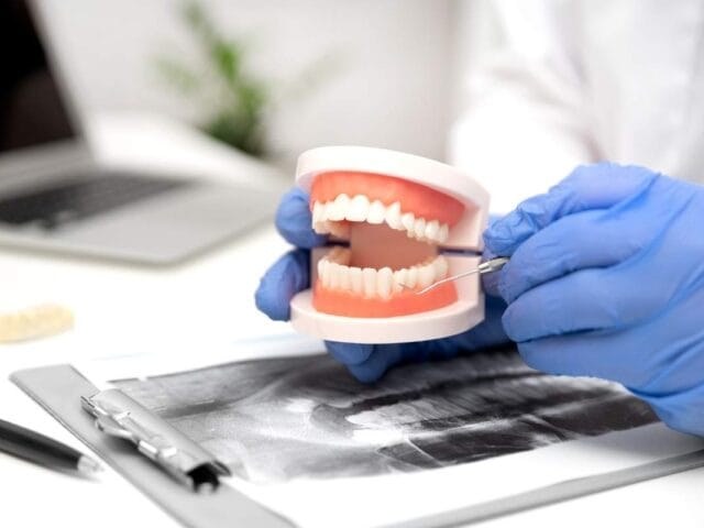 Zigomatik İmplant Nedir? Zigomatik İmplant Nasıl Yapılır?