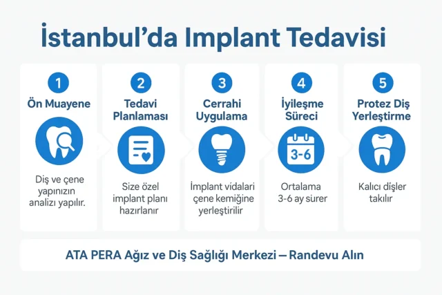 İstanbul da implant tedavisi süreci İstanbul da implant tedavisi süreci