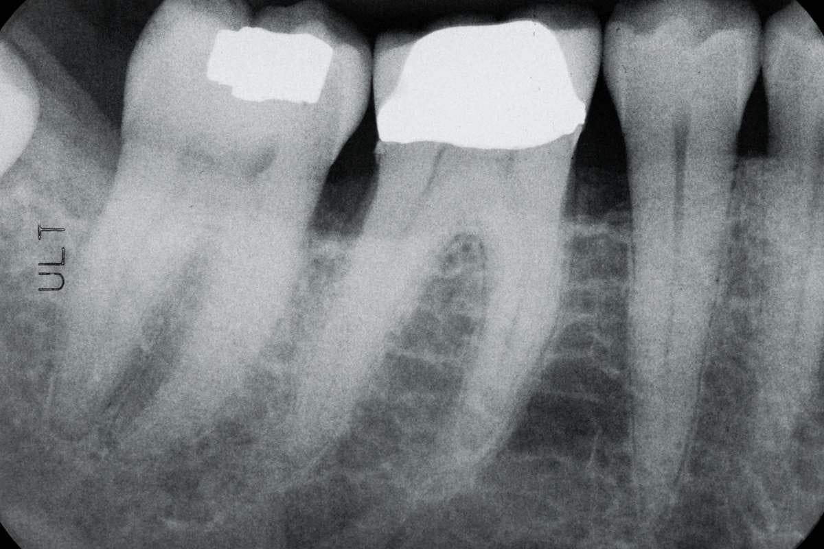Periodontoloji Nedir Periodontoloji Nedir