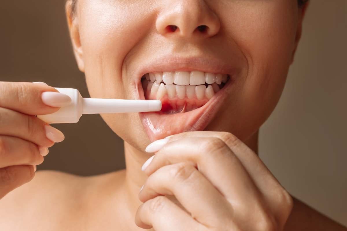 Periodontoloji https://atapera.com/wp-content/uploads/2025/05/Periodontoloji.jpg
